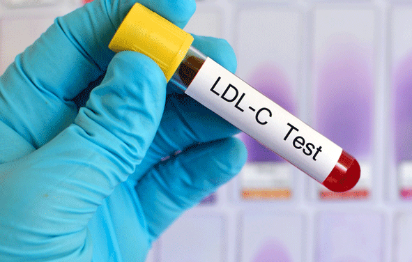 LDL-Cholesterin – gemessen