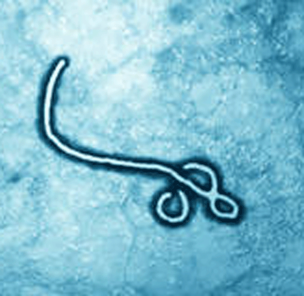 Ebola-Fieber